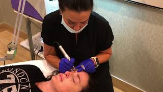 Permanent Makeup at the Aesthetic Surgery Center