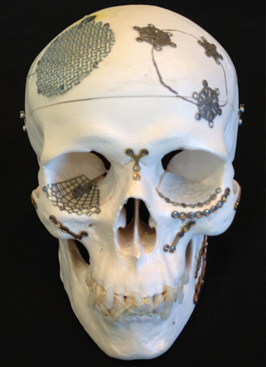 Facial Trauma Naples FL