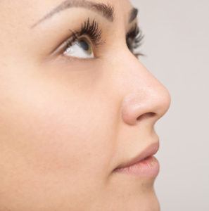 after rhinoplasty