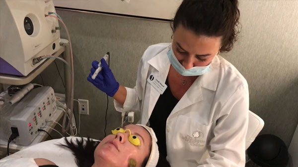 Aestheticians at Aesthetic Surgery Center demonstrate Microneedling Technique