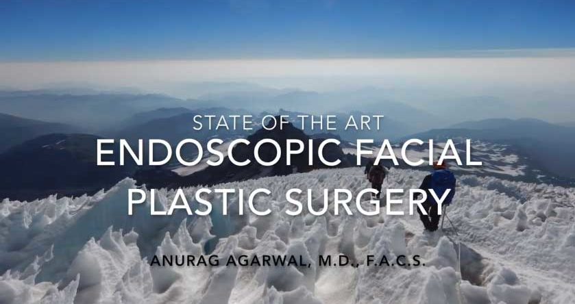 Endoscopic facial plastic surgery by Anurag Agarwal