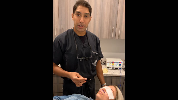 The Subnasal lip lift, Bullhorn lip lift, Upper lip lift by Dr. Anurag Agarwal