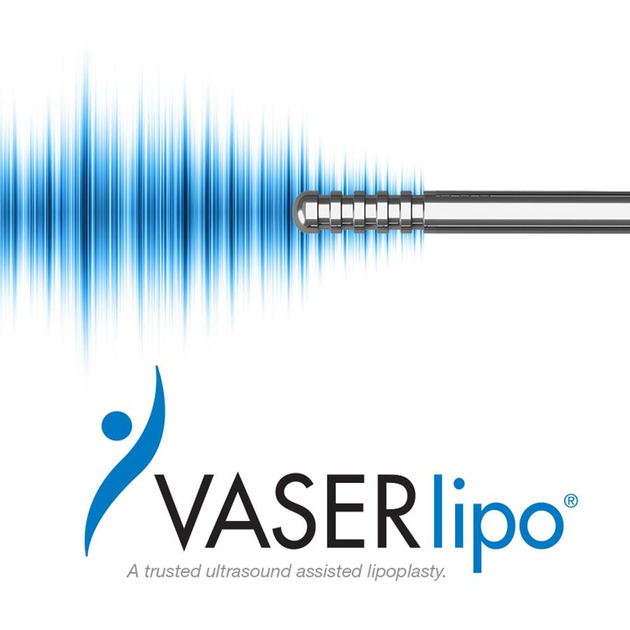 VASER® Liposuction