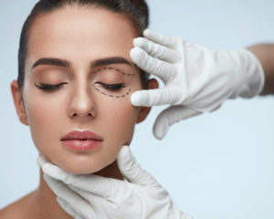 Eyelid Surgery Fort Myers - Blepharoplasty Fort Myers FL - Frantz