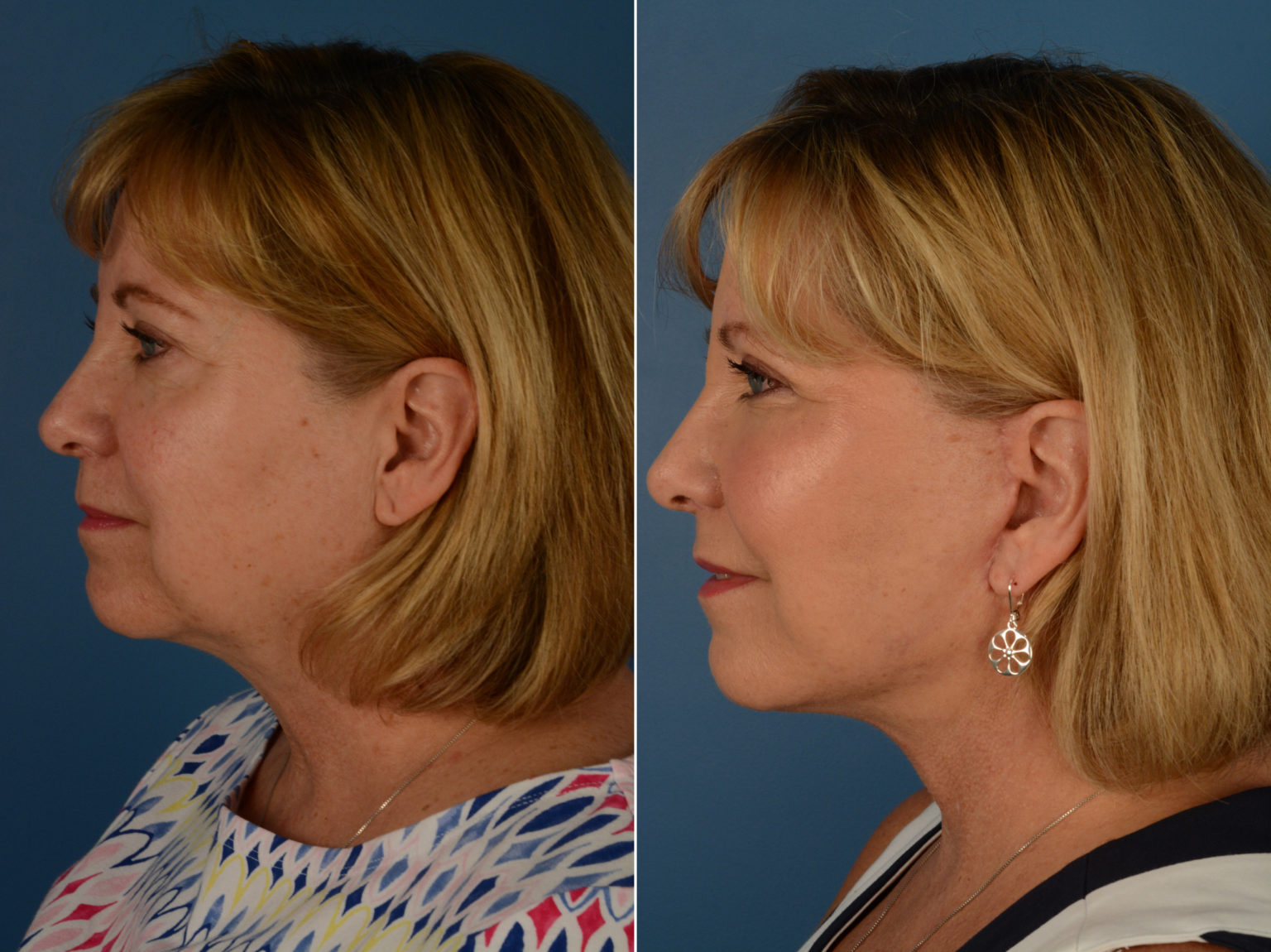 let us uplift facebar let us uplift facebar