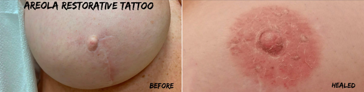 Permanent Makeup Before and After Photos in Naples, FL, Patient 19018
