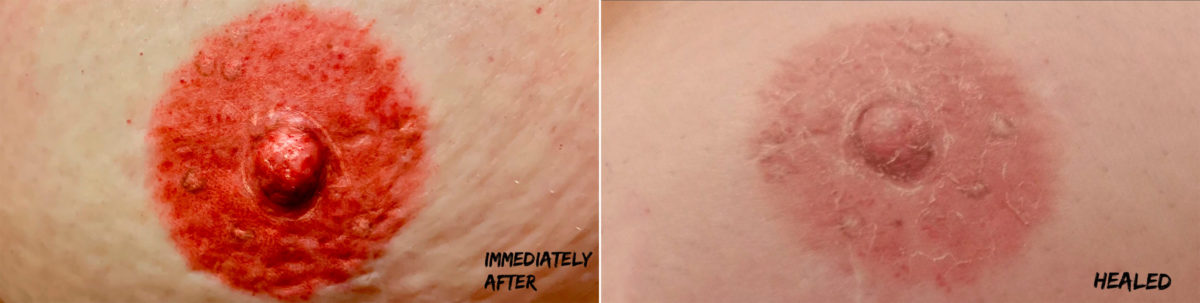 Permanent Makeup Before and After Photos in Naples, FL, Patient 19018