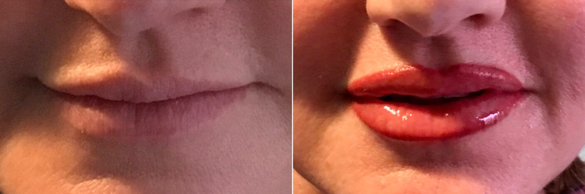 Permanent Makeup Before and After Photos in Naples, FL, Patient 19019