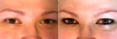 Permanent Makeup Before and After Photos in Naples, FL, Patient 19038