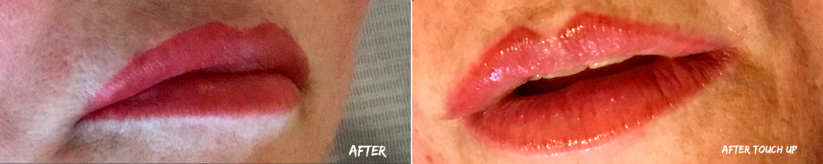 Permanent Makeup Before and After Photos in Naples, FL, Patient 19057