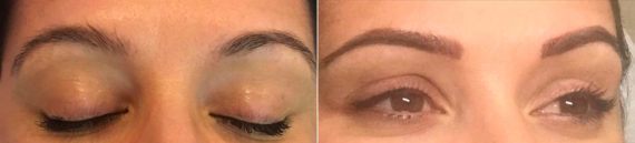 Permanent Makeup Before and After Photos in Naples, FL, Patient 19058