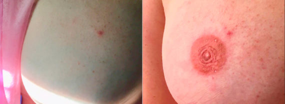 Permanent Makeup Before and After Photos in Naples, FL, Patient 19075