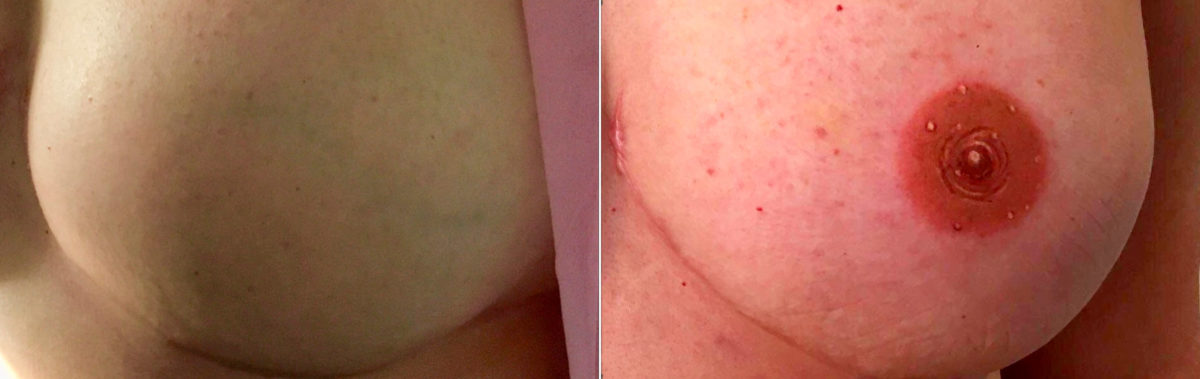 Permanent Makeup Before and After Photos in Naples, FL, Patient 19075