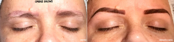 Permanent Makeup Before and After Photos in Naples, FL, Patient 19076