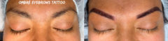 Permanent Makeup Before and After Photos in Naples, FL, Patient 19102