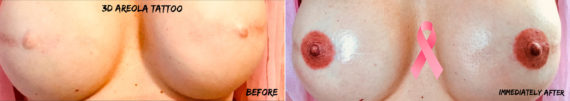 Permanent Makeup Before and After Photos in Naples, FL, Patient 19103