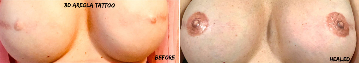 Permanent Makeup Before and After Photos in Naples, FL, Patient 19103