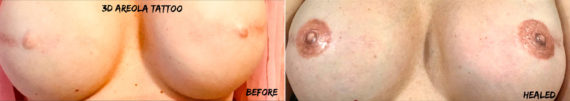 Permanent Makeup Before and After Photos in Naples, FL, Patient 19103