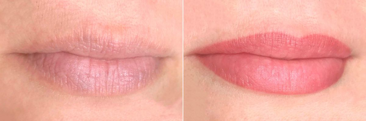 Permanent Makeup Before and After Photos in Naples, FL, Patient 19039