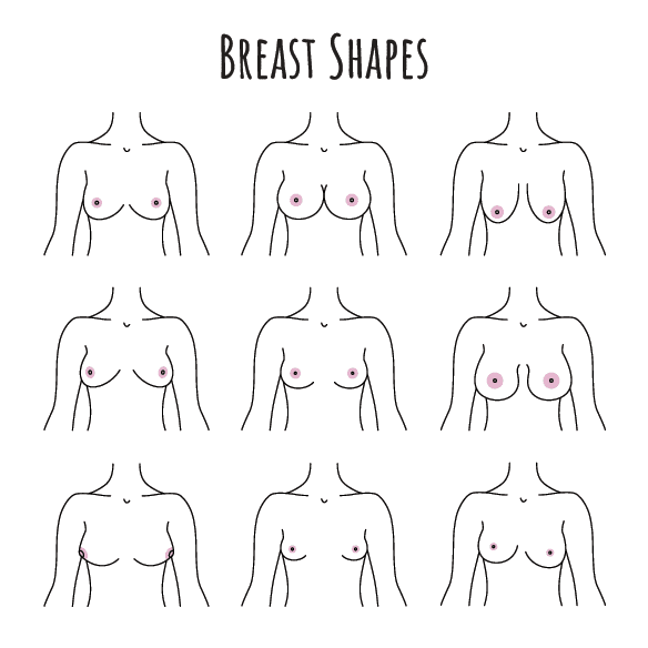 Small pointy breasts- want to fix shape but avoid implants and