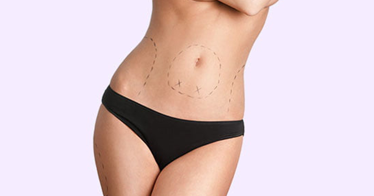 Body Contouring Naples, FL
