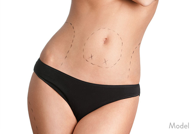 Body Procedures Naples Florida