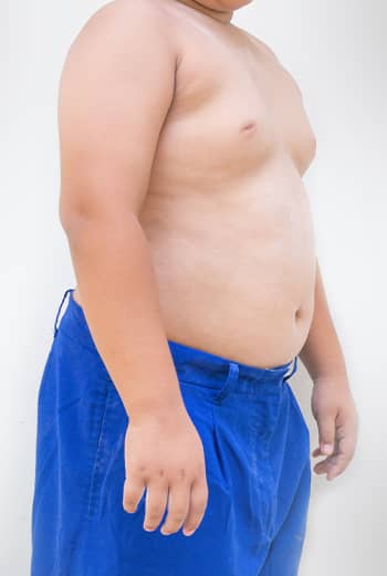 In some cases, Gynecomastia medical cause are hormonal changes, aging, medication use, obesity, or simply genetics.