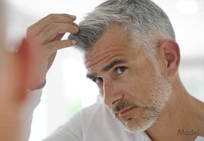 Hair Restoration Naples Florida