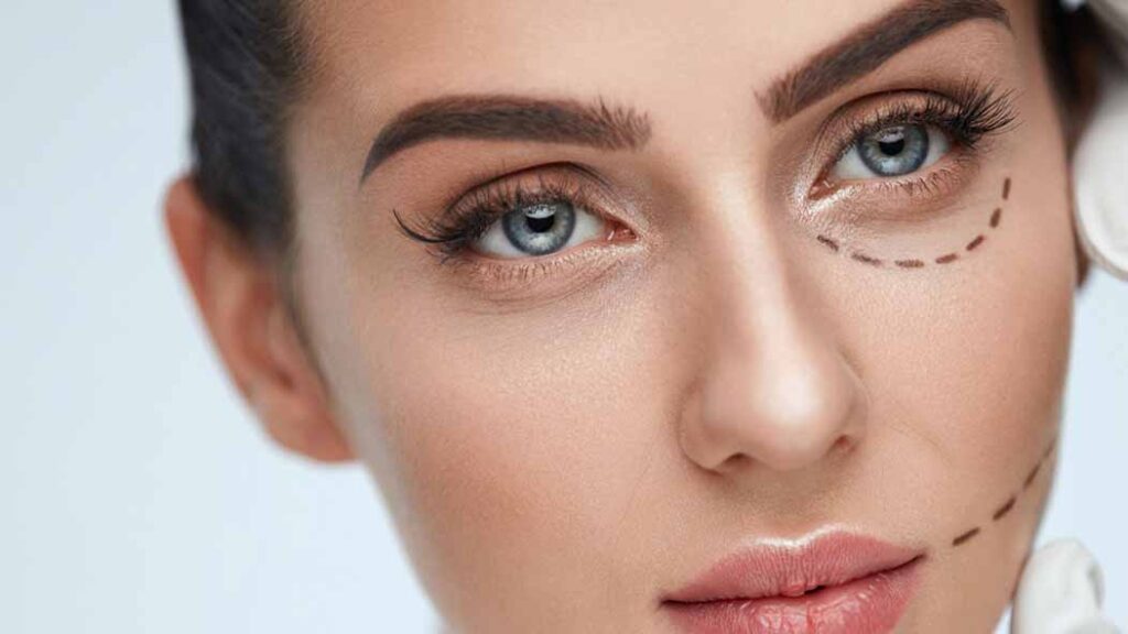 These items can make blepharoplasty have a quick and secure recovery. 