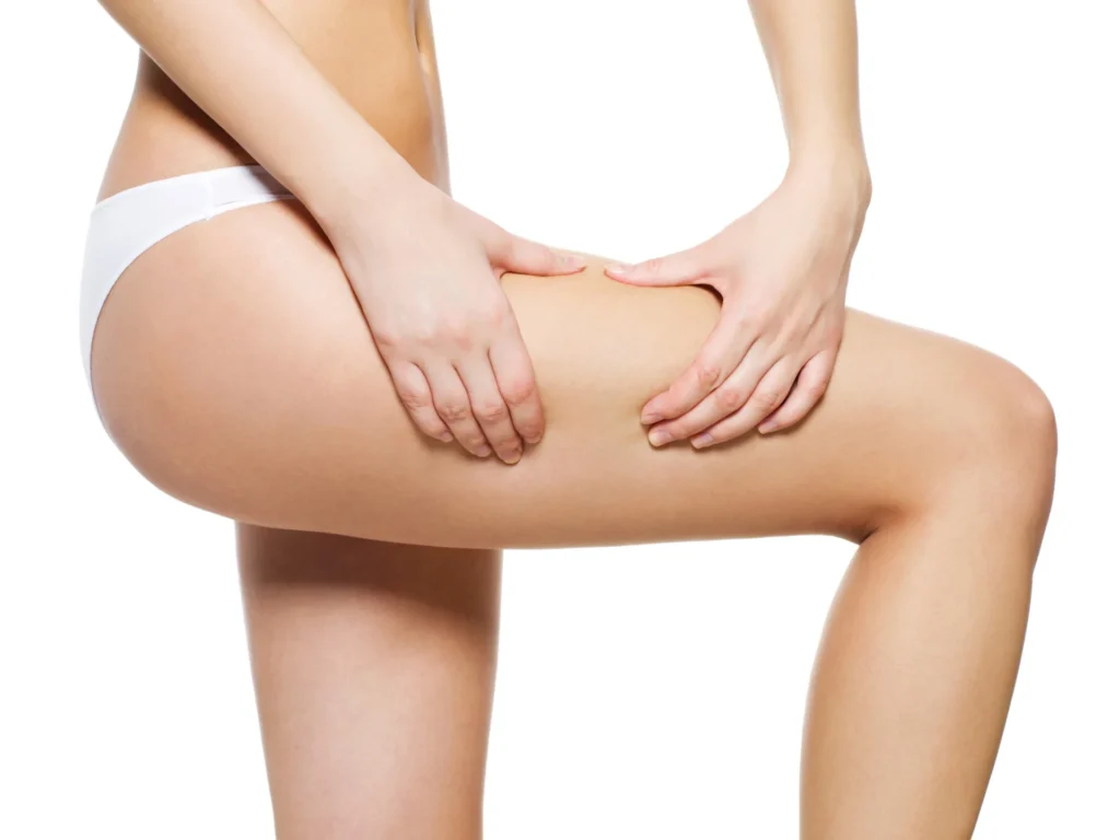 Thigh Lift in Naples, FL provided by Dr. Anurag Agarwal expertise achieves outstanding results.