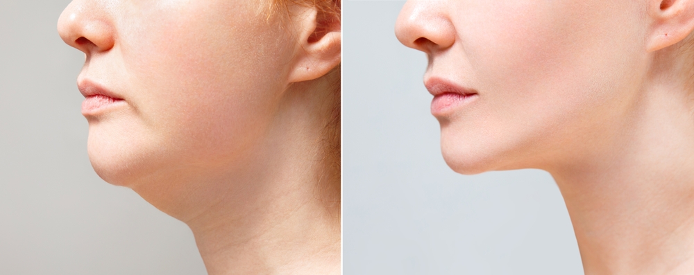 Our expert surgeons provide the outstanding results while ensuring the patient safety.