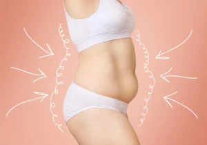 Ideal candidates for plus-size liposuction are those with stable weight, good overall health, and a desire for body reshaping rather than significant weight loss.