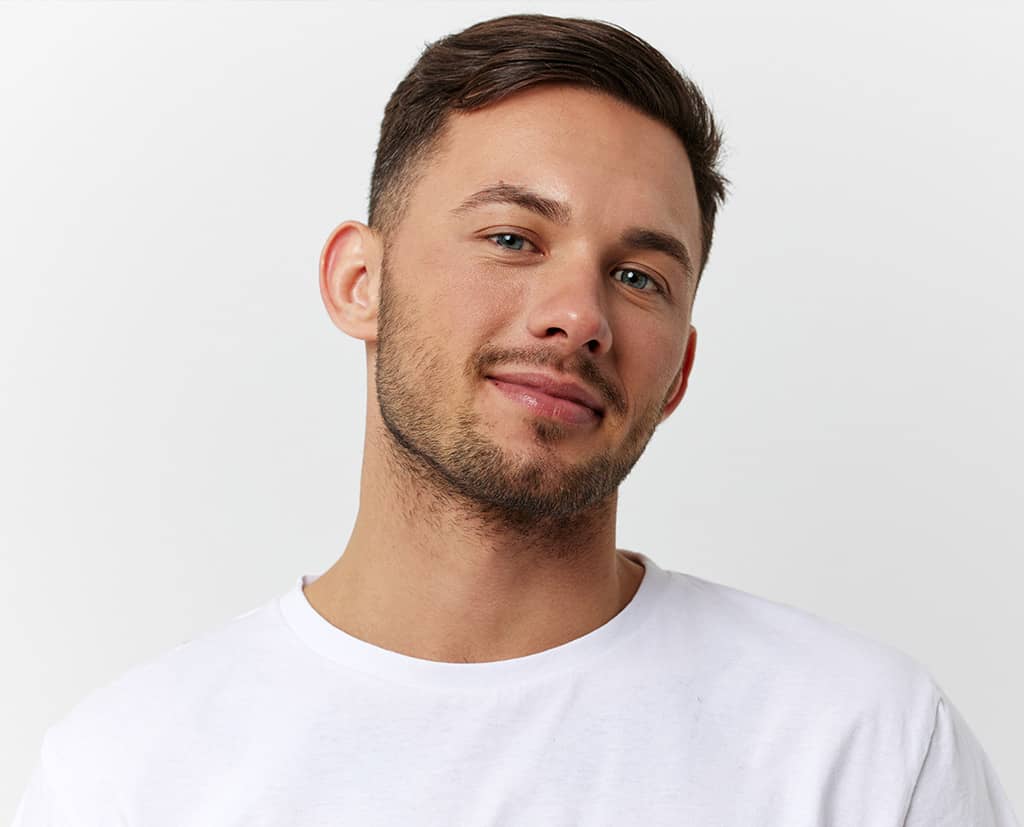 Man with naturally full eyebrows and facial hair after an eyebrow hair transplant in Naples, FL.