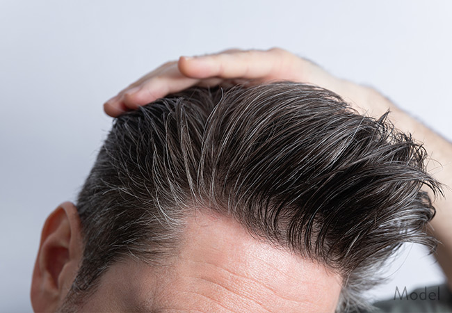 Hair Procedures Naples FL