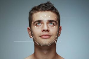 A close-up studio portrait of a young man looking upward, featuring white diagrammatic lines and arrows overlaid on his face illustrating facial structure mapping and potential surgical lifting directions.