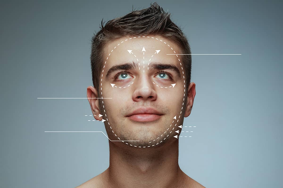A close-up studio portrait of a young man looking upward, featuring white diagrammatic lines and arrows overlaid on his face illustrating facial structure mapping and potential surgical lifting directions.