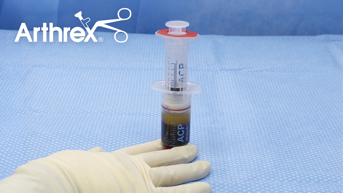Arthrex ACP® Platelet-Rich Plasma (PRP) System: Centrifugation and PRP Separation