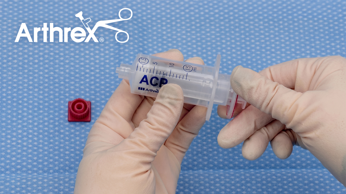 Arthrex ACP® Platelet-Rich Plasma (PRP) System: Centrifugation and PRP Separation