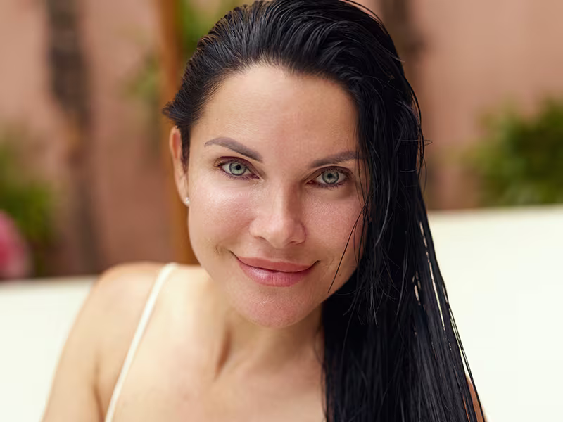 Woman with fresh-looking skin, representing the recovery period after PRP with microneedling in Naples, FL.